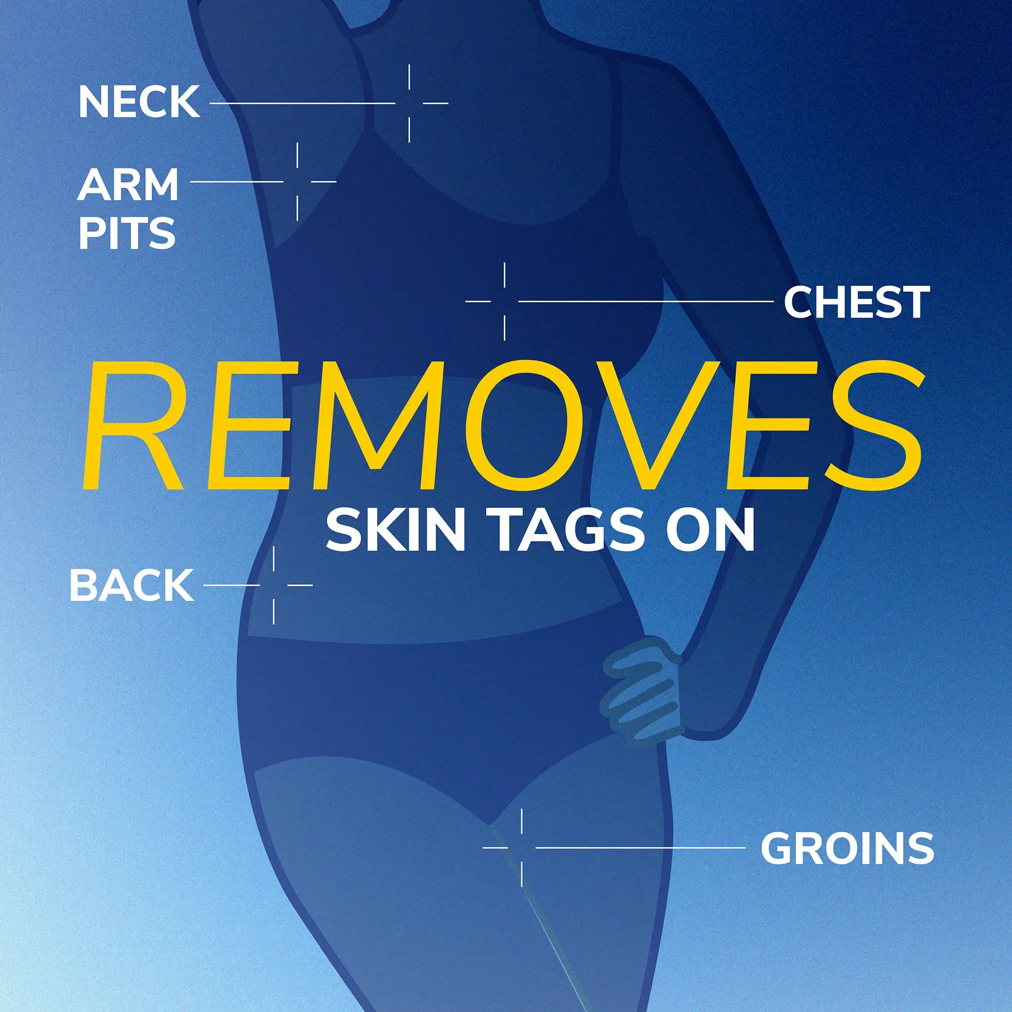 Freeze Away  Skin Tag Remover - Image 7